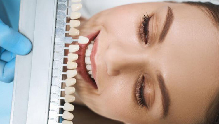 Diş estetiği ile güzel ve sağlıklı gülüşler